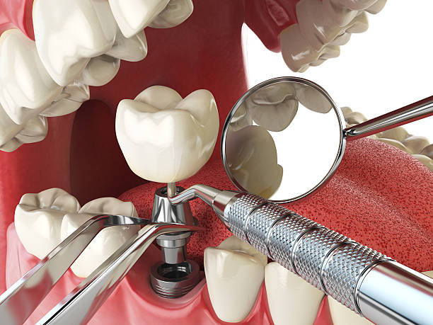 Best Emergency Care for Gum Disease in Deer Park, IL